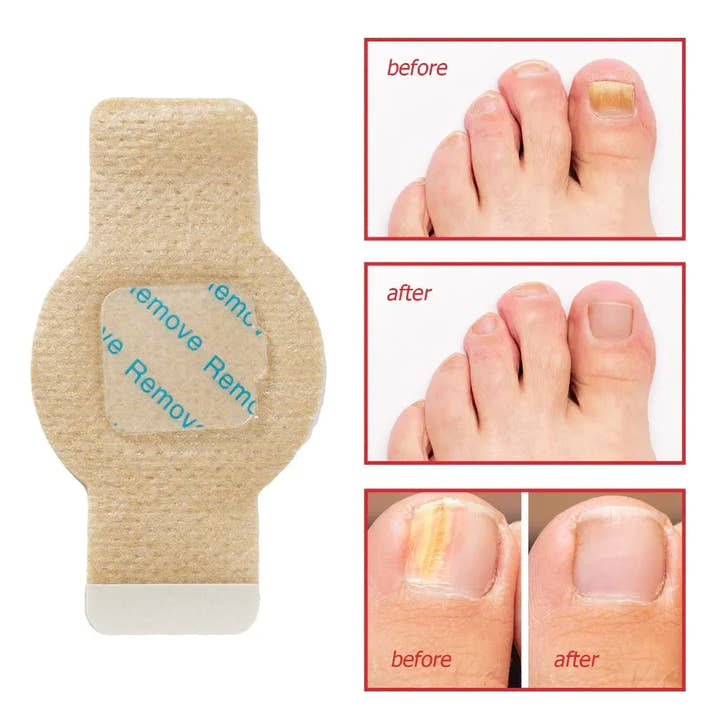 Nail Revival Patches™