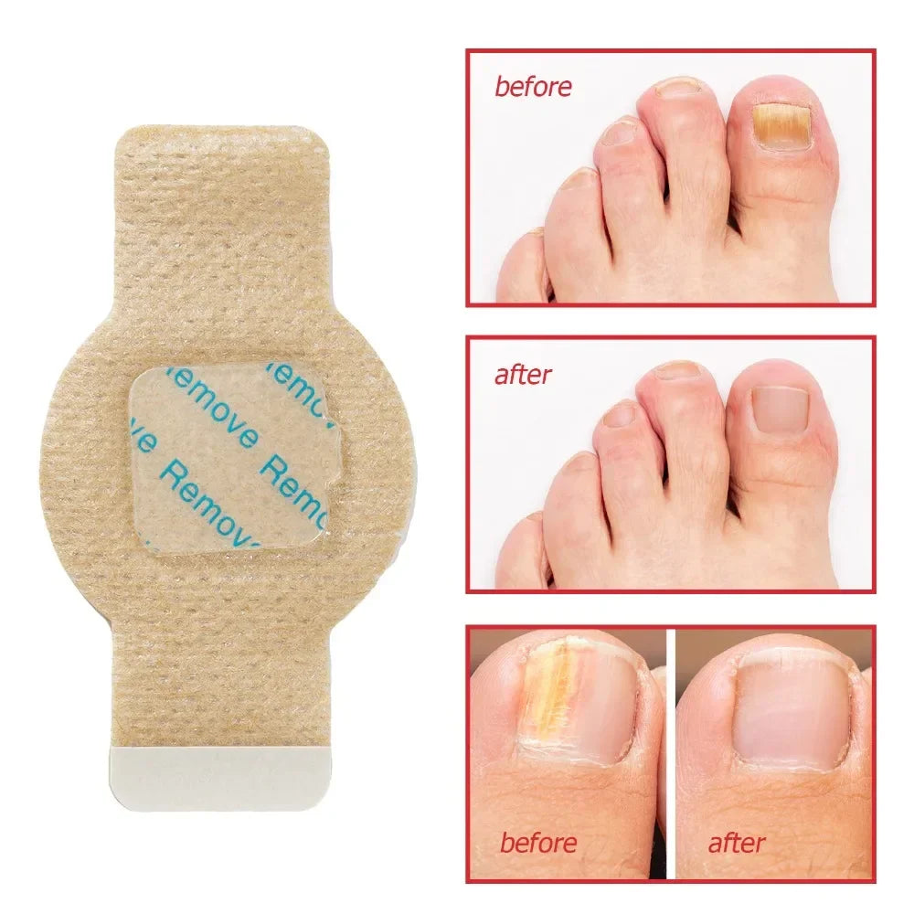 Nail Revival Patches™